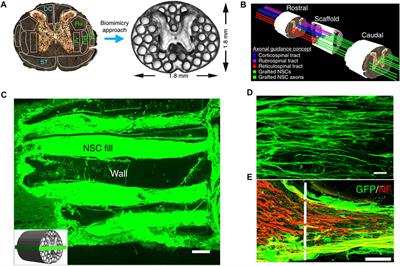 3D Bioprinting for Spinal Cord Injury Repair